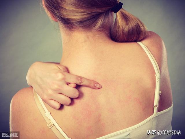 后背上长痘痘怎么消除胸前后背长痤疮的原因