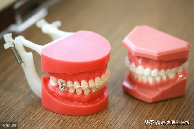 镶牙后要注意什么?提醒:应避开这3大误区