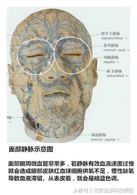 常年黑眼圈怎么回事?拒绝熊猫眼,击退黑眼圈!