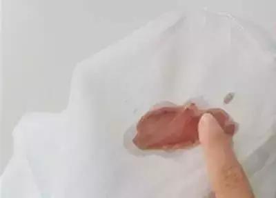 �·�����Ⱦ��ʲô�������ж���ϴ����̫ʵ���ˣ�