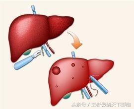 头晕恶心想吐是怎么回事?赶紧收藏以备不时之需