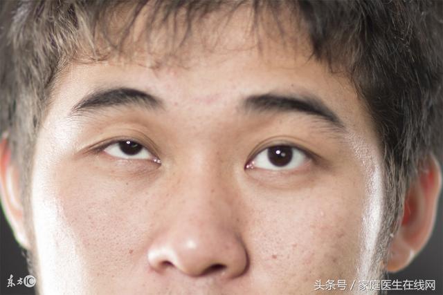 眼皮会一直跳,可能是身体有这3个大问题!别知道太晚了