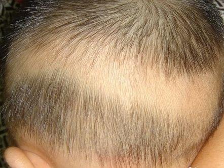 宝宝头发枯黄稀少怎么办?家长做好这5点,宝宝头发乌黑又浓密!