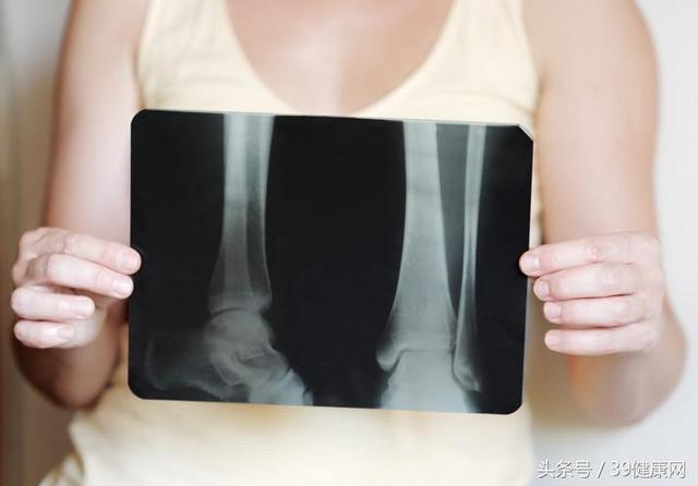 骨折病人吃什么好?是多喝骨头汤还是要补钙?