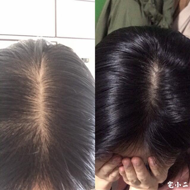 资生堂不老林洗发水怎么样,资生堂不老林洗发水有效果吗?