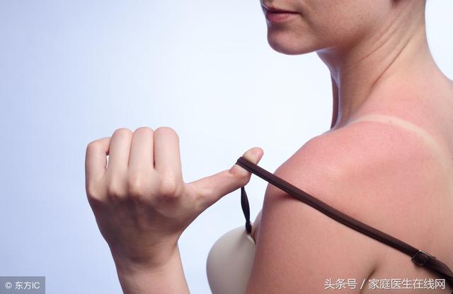 皮肤被晒伤后该怎么办?7个应对措施,帮你“修复”皮肤