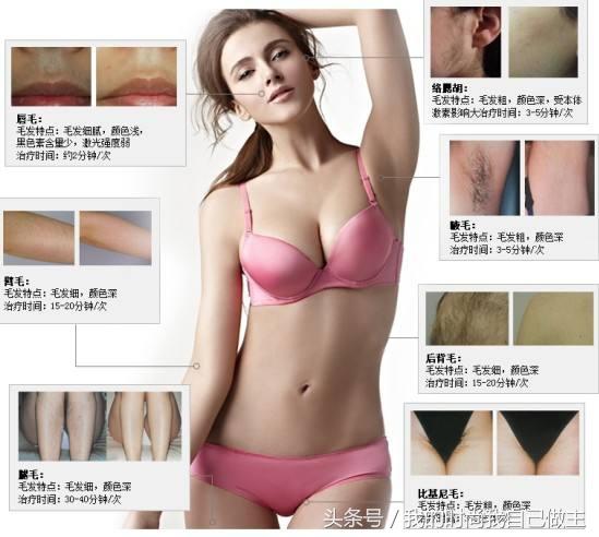脱毛最持久又立马见效的方法,你还不试试?