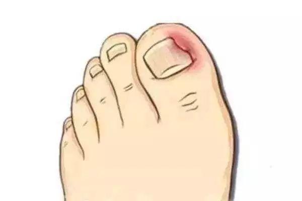 ָ���������ﳤ��һ�����ۣ�����һ���Լ�����������鷳ҽ����