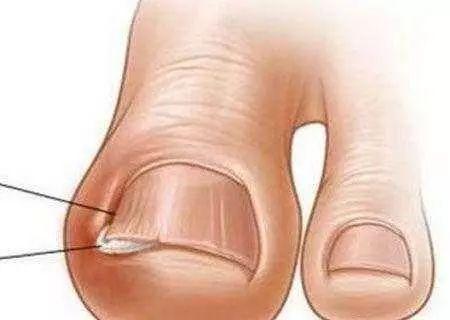 ָ���������ﳤ��һ�����ۣ�����һ���Լ�����������鷳ҽ����