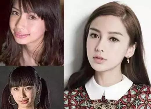 妹子,我得了相思病,还有得治吗