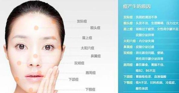 额头上总是长痘痘,怎么办?