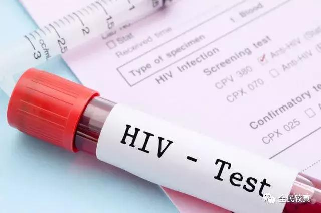 ��HIV�������ԡ����̲�����ζ��ʲô����Ҫ������
