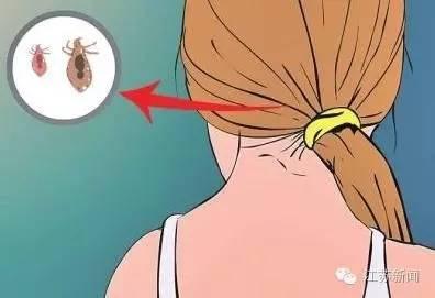 6����Ůͷ����ʭ�ӣ����ž�Ȼ�õе�η����ϴͷ����Ч�����û���ë������