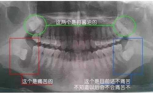 Ϊʲô���˳��ǳݣ�������ȴ�������᳤��