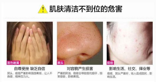 下巴老是长痘痘怎么回事?教你从源头祛痘!