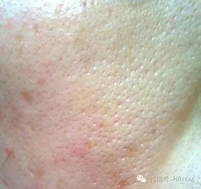 ���ë�״ִ� ��6������ԭ�����֣�